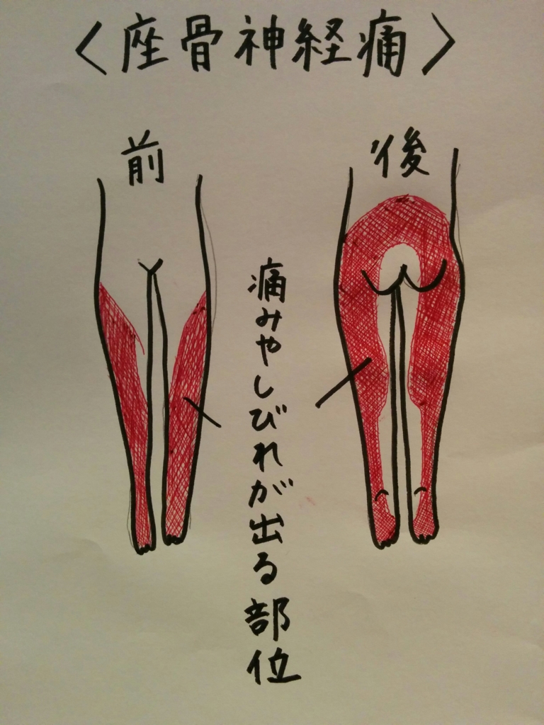 f:id:rigaku1:20151203104636j:plain f:id:rigaku1:20151203104636j:plain